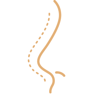 Female laser hair removal